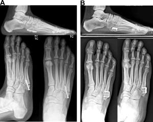 1 Cubic Inch, With Bone (yield After Bone Removed) Cooked Ray